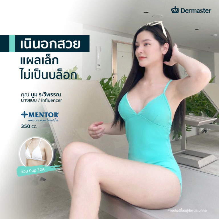 dermaster-breast-augmentation-thailand-mentor-1